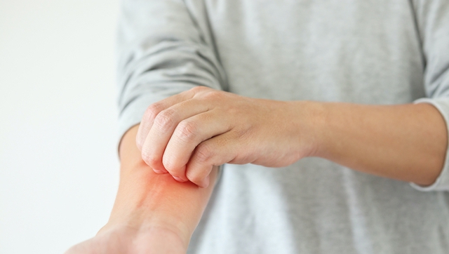 Người đàn ông 40 tuổi phát hiện ung thư gan giai đoạn cuối: Đáng tiếc ông đã bỏ qua dấu hiệu suốt 3 tháng- Ảnh 1.