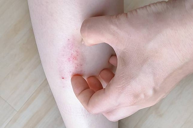 Người đàn ông 40 tuổi phát hiện ung thư gan giai đoạn cuối: Đáng tiếc ông đã bỏ qua dấu hiệu suốt 3 tháng- Ảnh 2.