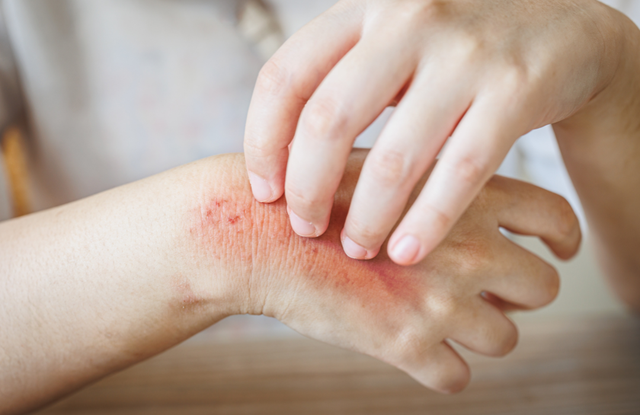 Người đàn ông 40 tuổi phát hiện ung thư gan giai đoạn cuối: Đáng tiếc ông đã bỏ qua dấu hiệu suốt 3 tháng- Ảnh 4.