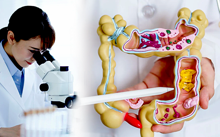 Vì sao ngày càng nhiều người trẻ mắc ung thư? - Ảnh 2.