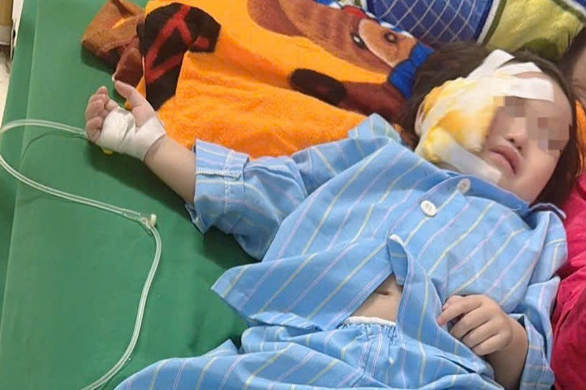 Sập trần thạch cao giờ ngủ trưa, một trẻ mầm non bị thương nặng- Ảnh 2.