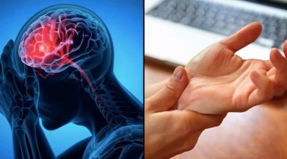 Theo các chuyên gia, nguy cơ đột quỵ tăng cao ở những người có bệnh lý tim mạch, rối loạn chuyển hóa hoặc lối sống thiếu lành mạnh. 