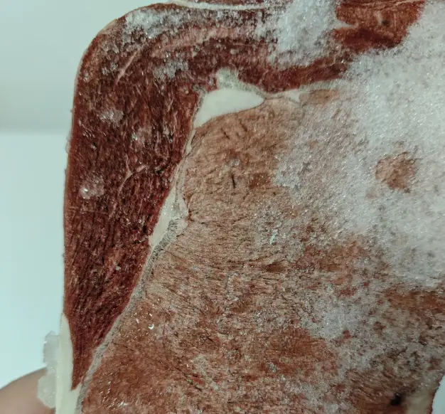 Thịt ᵭể tủ ᵭá trȏng như thḗ này tṓt nhất nên vứt ᵭi, cho trẻ con ăn càng nguy hiểm! - Ảnh 2.