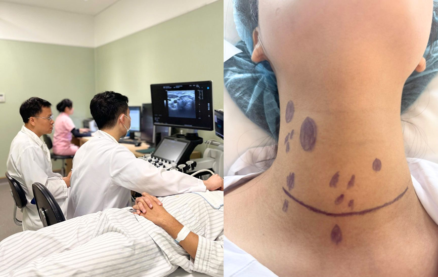 Cô gái 24 tuổi ở Hà Nội phát hiện ung thư tuyến giáp di căn hơn 20 hạch sau khi sờ thấy 1 thứ ở cổ- Ảnh 1.