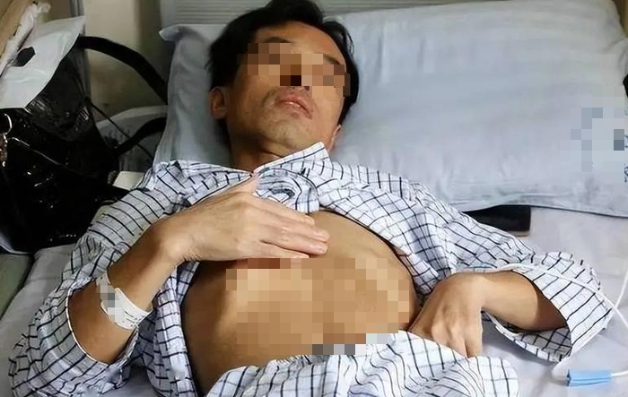 Người đàn ông 53 tuổi nhận "án tử" ung thư gan, bác sĩ tức giận: Đừng làm việc này quá 3 lần 1 tháng! - áº¢nh 1.